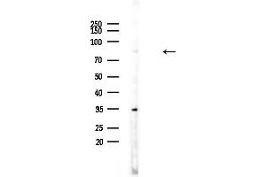 anti-Calpain 12 (CAPN12) (Internal Region) antibody