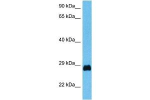 Host:  Mouse  Target Name:  PDX1  Sample Tissue:  Mouse Testis  Antibody Dilution:  1ug/ml (PDX1 Antikörper  (N-Term))