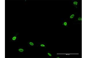 Immunofluorescence (IF) image for anti-TNNI3 Interacting Kinase (TNNI3K) (AA 1-843) antibody (ABIN526441)