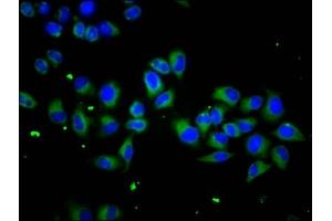 Immunofluorescence staining of Hela cells with ABIN7169635 at 1:133, counter-stained with DAPI. (SCUBE1 Antikörper  (AA 453-566))
