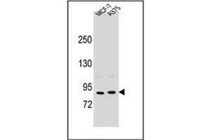 Western blot analysis of Periostin Antibody (C-term) in MCF-7, A375 cell line lysates (35ug/lane). (Periostin Antikörper  (C-Term))