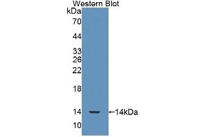Western blot analysis of the recombinant protein. (SRP9 Antikörper  (AA 2-86))