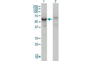 Lane 1: DDX56 transfected lysate ( 62 KDa). (DDX56 HEK293 Cell Transient Overexpression Lysate(Non-Denatured))
