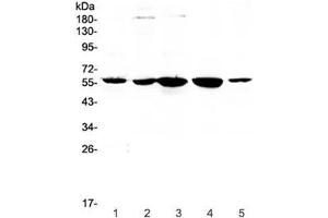 Western blot testing of human 1) placenta, 2) HeLa, 3) 22RV1, 4) SKOV and 5) A549 lysate with ETV6 antibody at 0. (ETV6 Antikörper)