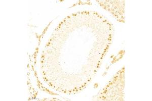 Immunohistochemistry of paraffin embedded rat testis using APOBEC4 (ABIN7073086) at dilution of 1:800 (200x lens) (APOBEC4 Antikörper)