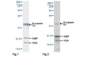 Kinase Activity Assay (KAA) image for zeta-Chain (TCR) Associated Protein Kinase 70kDa (ZAP70) (AA 1-493) protein (GST tag) (ABIN1325570) (ZAP70 Protein (AA 1-493) (GST tag))