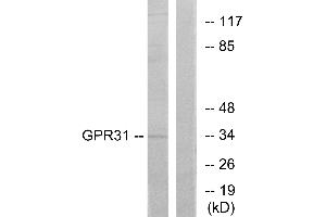 Western blot analysis of extracts from COLO cells, using GPR31 antibody. (GPR31 Antikörper)