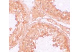 Immunohistochemical staining of human testis cells with NLRP9 polyclonal antibody  at 10 ug/mL. (NLRP9 Antikörper  (N-Term))