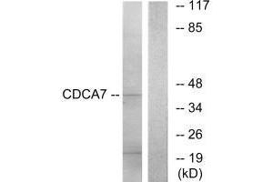 Western blot analysis of extracts from K562 cells, using CDCA7 antibody. (CDCA7 Antikörper)