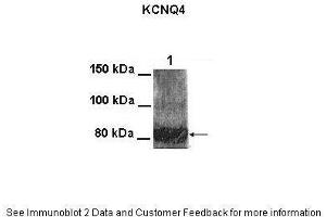 Lanes:   100 ug CHO cell lysate  Primary Antibody Dilution:   1:1000  Secondary Antibody:   Goat anti-rabbit HRP  Secondary Antibody Dilution:   1:25000  Gene Name:   KCNQ4  Submitted by:   Anonymous (KCNQ4 Antikörper  (Middle Region))
