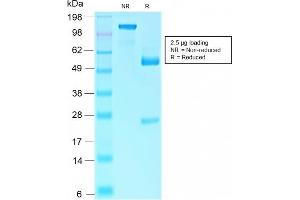 SDS-PAGE Analysis Purified Retinoblastoma Recombinant Rabbit Monoclonal Antibody (RB1/2313R).