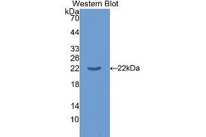 Western Blotting (WB) image for anti-Interleukin 17 Receptor B (IL17RB) (AA 166-354) antibody (ABIN1859362) (IL17 Receptor B Antikörper  (AA 166-354))