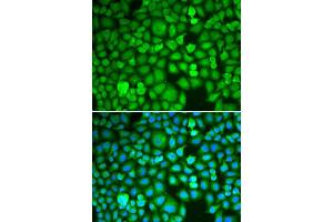 Immunofluorescence analysis of A549 cell using ETS1 antibody. (ETS1 Antikörper)