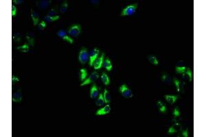 Immunofluorescence staining of Hela cells with ABIN7175204 at 1:66, counter-stained with DAPI. (VTCN1 Antikörper  (AA 26-258))