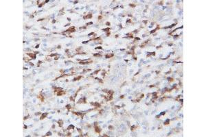 Immunohistochemistry (IHC) image for anti-Heat Shock Protein 90kDa beta (Grp94), Member 1 (HSP90B1) (AA 687-700), (Middle Region) antibody (ABIN3044299)