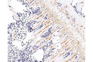 Immunohistochemistry analysis of paraffin-embedded rat bone using COL2A1 Monoclonal Antibody at dilution of 1:300. (COL2A1 Antikörper)