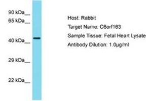 Image no. 1 for anti-Chromosome 6 Open Reading Frame 163 (C6ORF163) (AA 173-222) antibody (ABIN6750773) (C6ORF163 Antikörper  (AA 173-222))