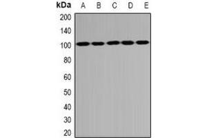 Western blot analysis of PSD95 expression in U87 (A), NIH3T3 (B), mouse thymus (C), rat brain (D), rat liver (E) whole cell lysates. (DLG4 Antikörper)