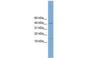 Image no. 1 for anti-Pre-B-Cell Leukemia Homeobox 4 (PBX4) (N-Term) antibody (ABIN6744610) (PBX4 Antikörper  (N-Term))