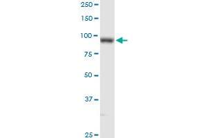 PLOD2 MaxPab rabbit polyclonal antibody. (PLOD2 Antikörper  (AA 1-758))