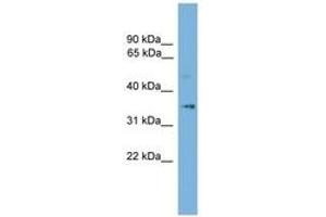 Image no. 1 for anti-Solute Carrier Family 25 (Mitochondrial Thiamine Pyrophosphate Carrier), Member 19 (SLC25A19) (AA 107-156) antibody (ABIN6744760)