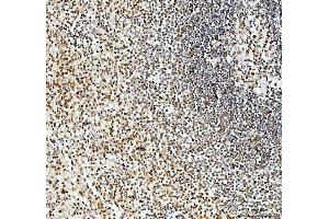 IHC analysis of SFPQ using anti-SFPQ antibody (ABIN7603089). (SFPQ Antikörper  (Middle Region))