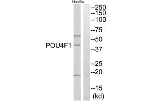 Western blot analysis of extracts from HuvEc cells, using POU4F1 antibody.