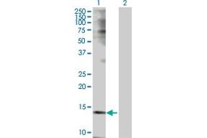 Western Blot analysis of TSPO expression in transfected 293T cell line by TSPO MaxPab polyclonal antibody. (TSPO Antikörper  (AA 1-169))