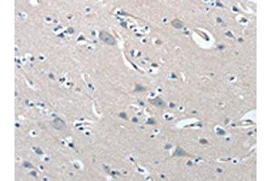The image on the left is immunohistochemistry of paraffin-embedded Human brain tissue using ABIN7192019(PRKX Antibody) at dilution 1/15, on the right is treated with synthetic peptide. (PRKX Antikörper)