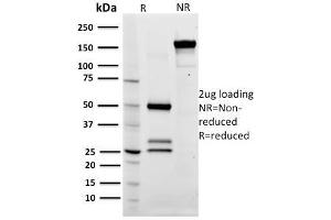 SDS-PAGE Analysis Purified CD79a Mouse Monoclonal Antibody (ZL7-4). (CD79a Antikörper)