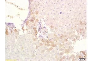 Formalin-fixed and paraffin embedded rat liver tissue labeled with Anti-ABCB6 Polyclonal Antibody, Unconjugated at 1:200, followed by conjugation to the secondary antibody and DAB staining (ABCB6 Antikörper  (AA 401-520))
