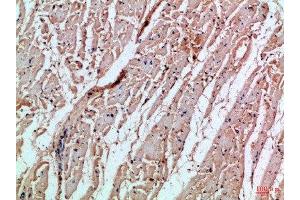 Immunohistochemical analysis of paraffin-embedded Human-heart, antibody was diluted at 1:100