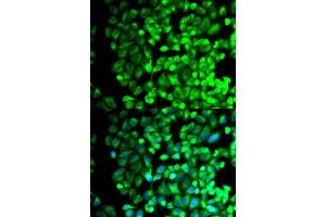 Immunofluorescence (IF) image for anti-thromboxane A Synthase 1 (Platelet) (TBXAS1) antibody (ABIN1875427) (TBXAS1 Antikörper)
