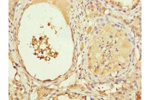 Immunohistochemistry of paraffin-embedded human testis tissue using ABIN7151076 at dilution of 1:100 (MYLIP Antikörper  (AA 266-445))