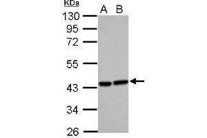 WB Image Sample (30 ug of whole cell lysate) A: HeLa B: HepG2 10% SDS PAGE antibody diluted at 1:500 (HMOX2 Antikörper)