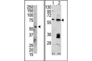 Image no. 1 for anti-Mdm2, p53 E3 Ubiquitin Protein Ligase Homolog (Mouse) (MDM2) (C-Term) antibody (ABIN356777) (MDM2 Antikörper  (C-Term))