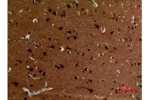 Immunohistochemistry (IHC) image for anti-Ubiquitin (Ub) (acLys27) antibody (ABIN3181496)