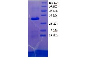 SDS-PAGE (SDS) image for Vestigial Like 3 (VGLL3) (AA 1-320), (partial) protein (His tag) (ABIN5713942) (VGLL3 Protein (AA 1-320, partial) (His tag))