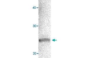 Western blot of MCF-7 cell extracts with CBX1 polyclonal antibody  at 1000 fold dilution. (CBX1 Antikörper  (AA 176-185))