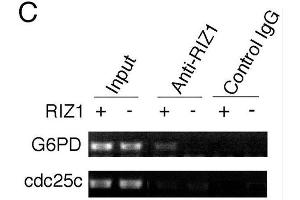 ChIP analysis of estrogen target genes. (PRDM2 Antikörper  (AA 1-347))