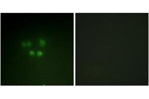 Immunofluorescence analysis of A549 cells, using Nibrin (Ab-278) Antibody. (Nibrin Antikörper  (AA 251-300))