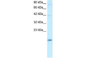 ApoBEC3G antibody used at 2 ug/ml to detect target protein. (APOBEC3G Antikörper  (N-Term))