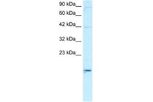ApoBEC3G antibody used at 2 ug/ml to detect target protein.