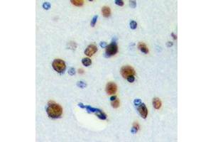 Immunohistochemical analysis of RFWD3 staining in human brain formalin fixed paraffin embedded tissue section. (RFWD3 Antikörper  (Center))