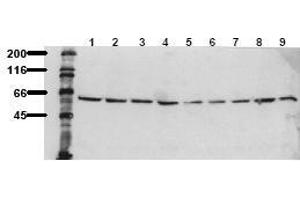 Western Blotting (WB) image for anti-V-Akt Murine Thymoma Viral Oncogene Homolog 1 (AKT1) (C-Term), (Ser473) antibody (ABIN126854) (AKT1 Antikörper  (C-Term, Ser473))
