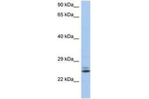 Image no. 1 for anti-RAB15, Member RAS Onocogene Family (RAB15) (AA 35-84) antibody (ABIN6743923) (RAB15 Antikörper  (AA 35-84))