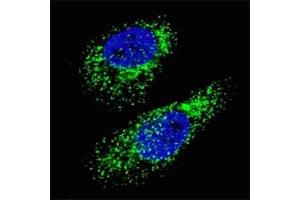 Fluorescent image of Chloroquine treated U251 cells (50 uM, 16h) stained with LC3A antibody.