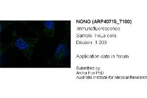 Image no. 2 for anti-Non-POU Domain Containing, Octamer-Binding (NONO) (N-Term) antibody (ABIN184023) (NONO Antikörper  (N-Term))