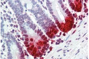 Human Small Intestine (formalin-fixed, paraffin-embedded) stained with DEFA5 antibody ABIN396940 at 10 ug/ml followed by biotinylated anti-mouse IgG secondary antibody ABIN481714, alkaline phosphatase-streptavidin and chromogen. (DEFA5 Antikörper)