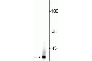 Western blot of rat kidney lysate showing specific immunolabeling of the ~21 kDa Park7 protein. (PARK7/DJ1 Antikörper)
